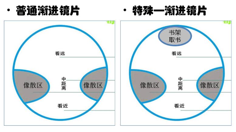 漸進(jìn)多焦鏡的原理與應(yīng)用，3個光區(qū)，看遠(yuǎn)近只需一副